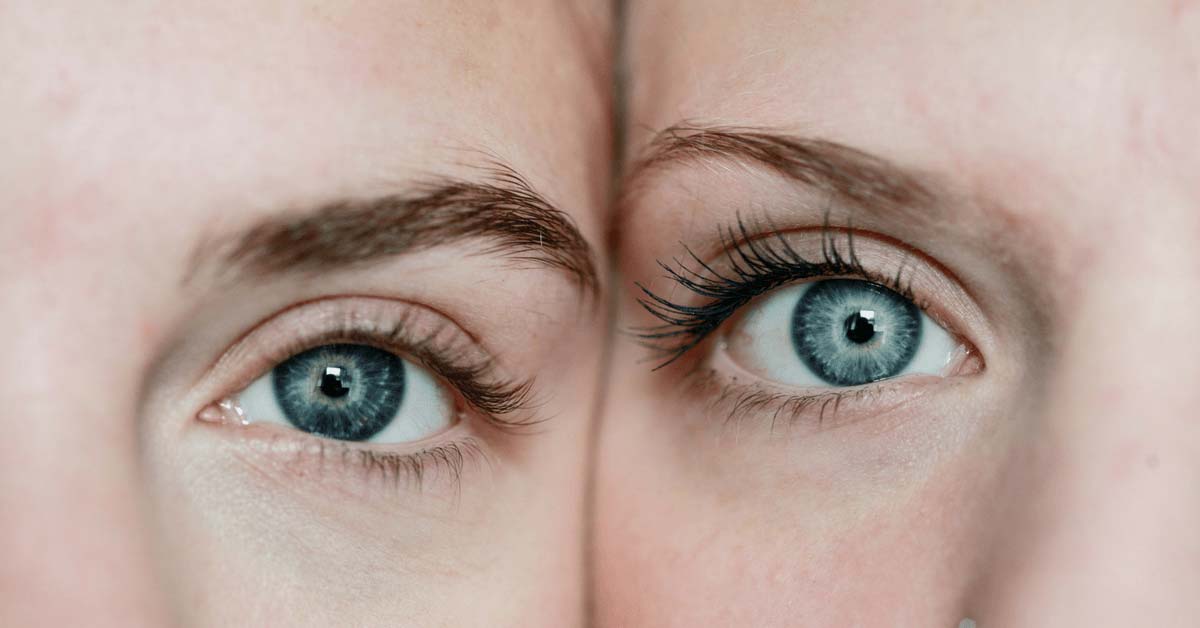 How Your Eyes Give Away Your Age Australian Skin Clinics