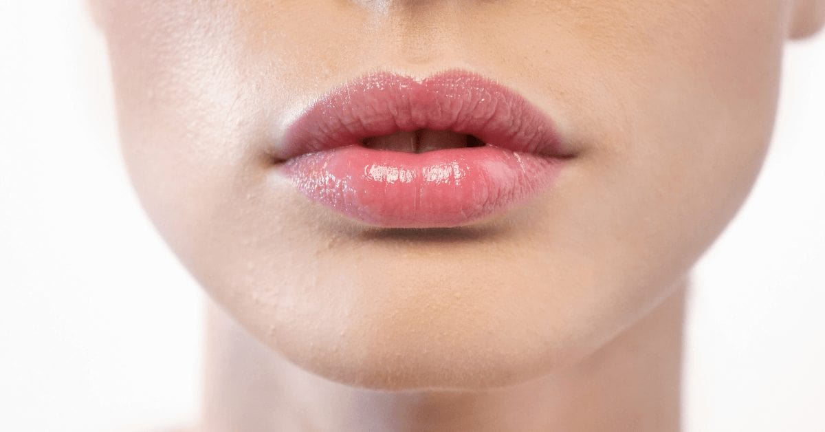 How to care for your lips after dermal filler | Australian Skin Clinics