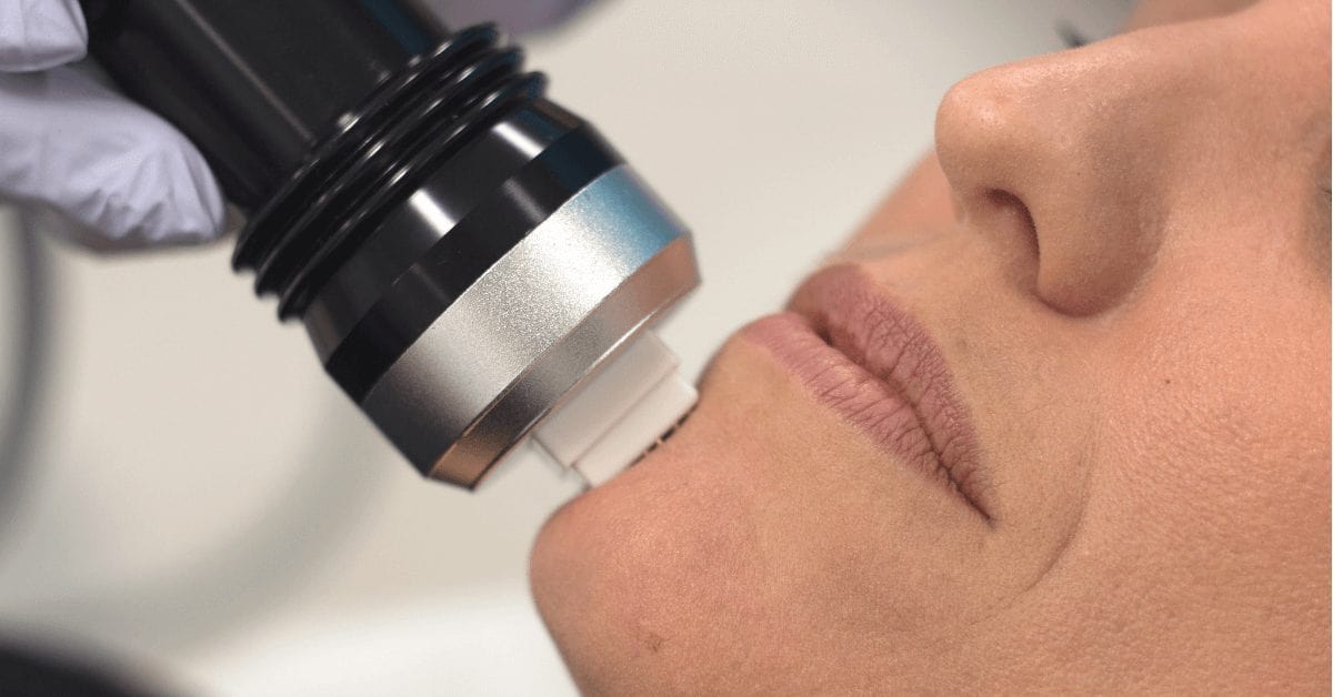 Fractional RF Skin Tightening Treatment | Australian Skin Clinics
