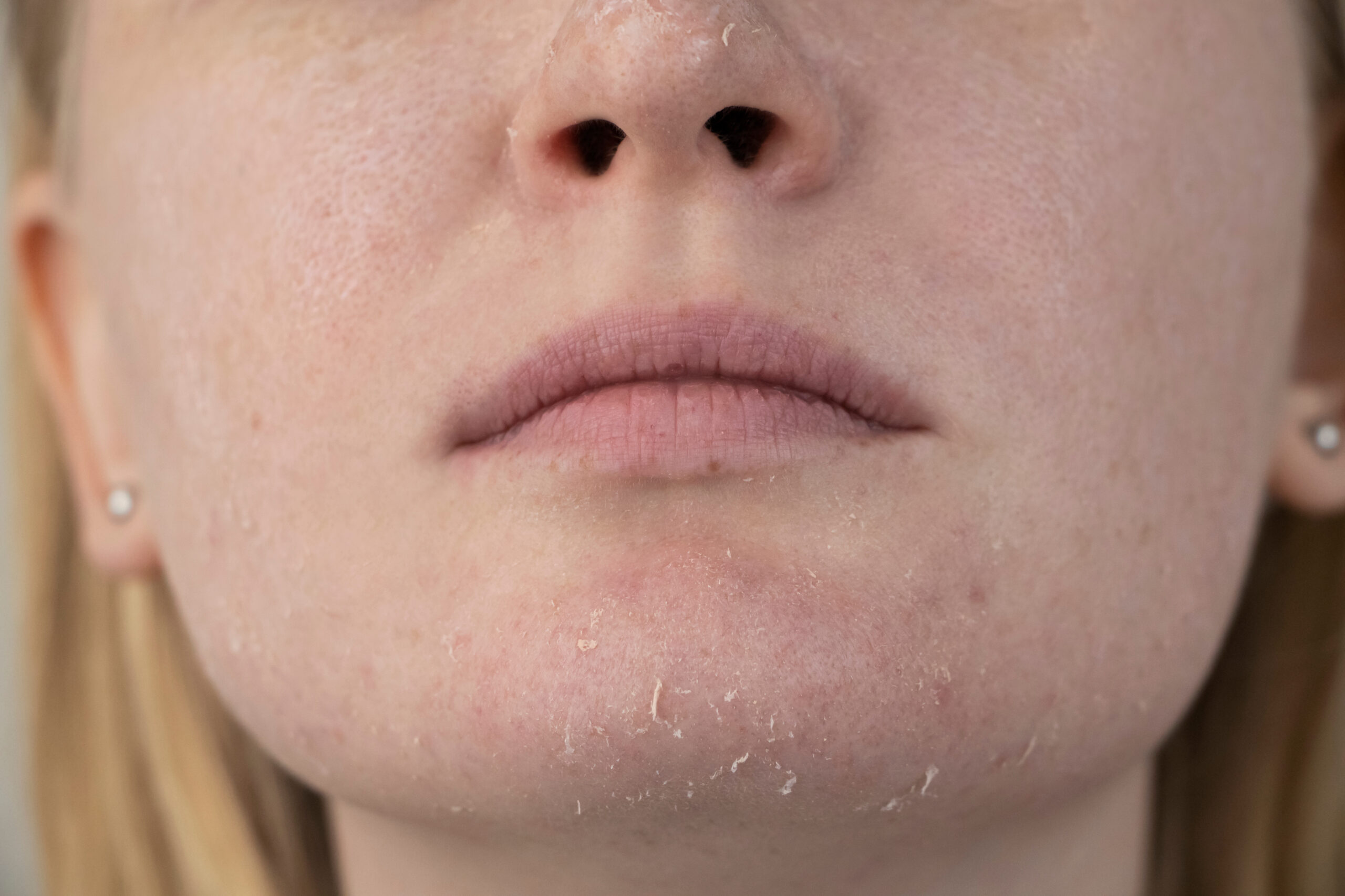 signs of dehydration on face