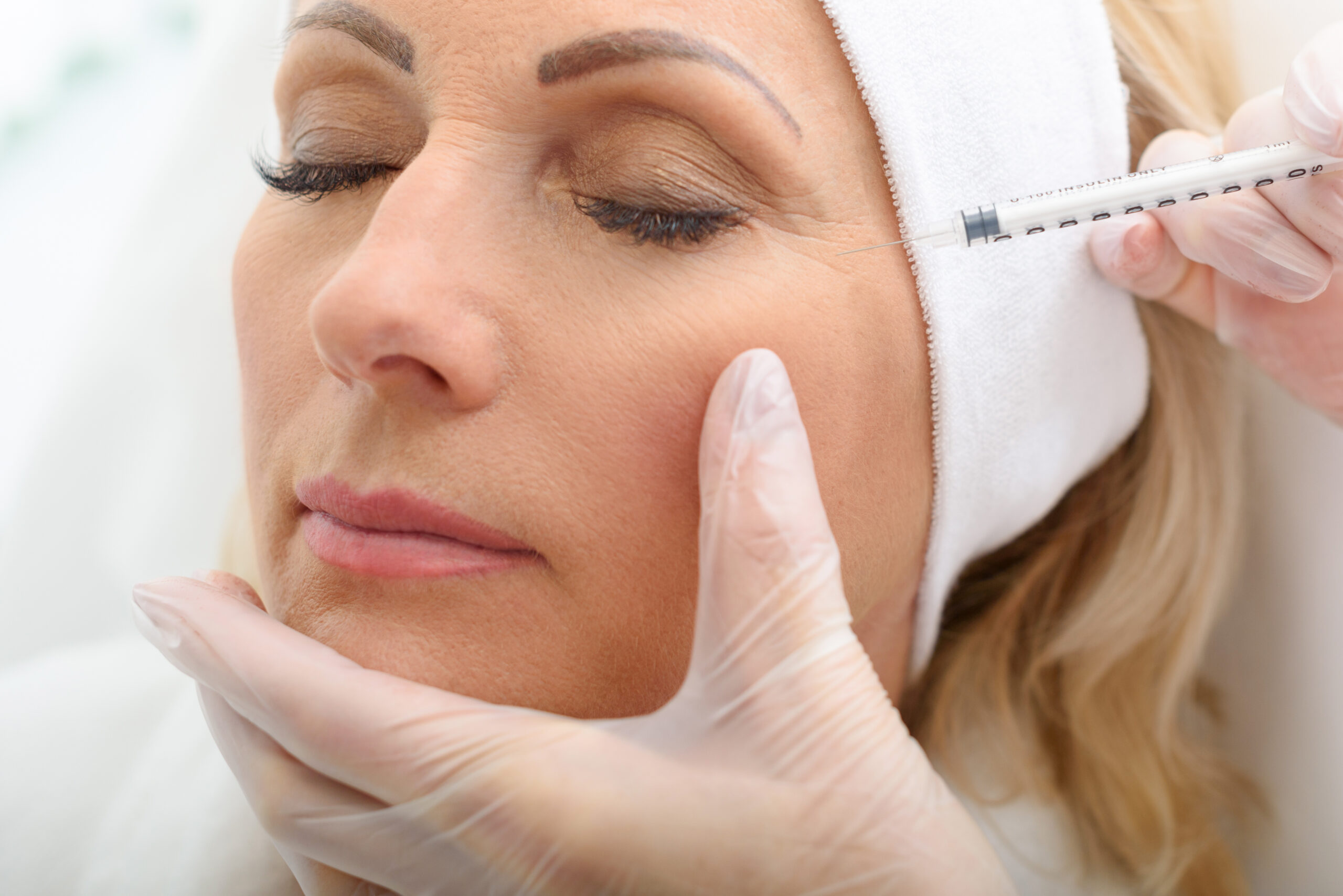 Top benefits of anti-wrinkle - Australian Skin Clinics