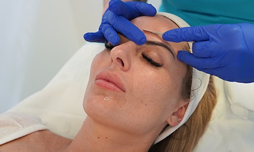 Dermaplanning Skin Treatments