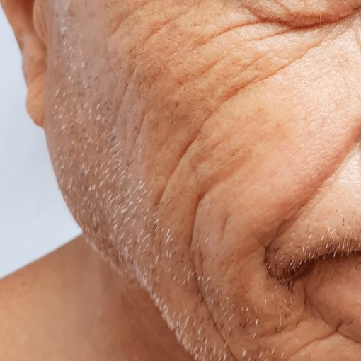 Anti aging Skin Care - Australian Skin Clinics