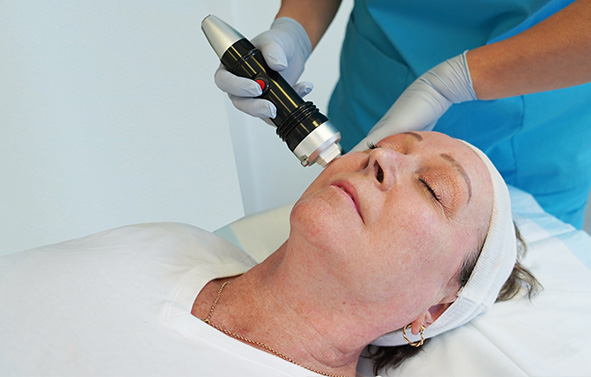 Fractional RF Needling Skin Treatment