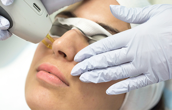 Laser for veins skin treatment