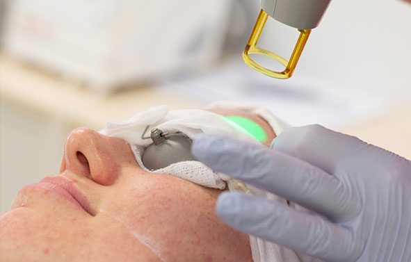 Laser for pigmentation Treatment and Skin Rejuvenation