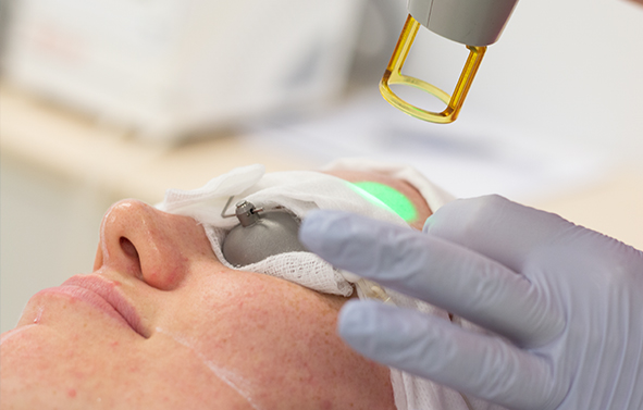 Laser for Pigmentation - Decolletage Featured Image