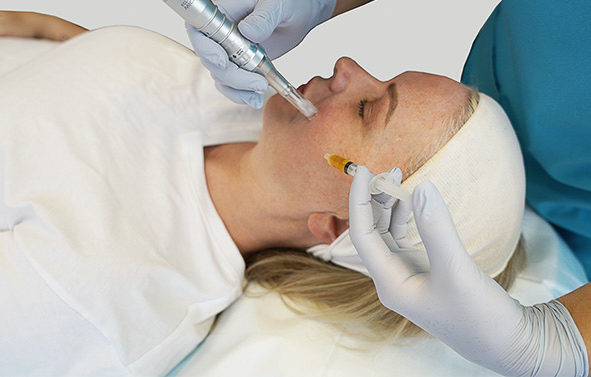 Rejuvenate & Renew - Skin Program Featured Image