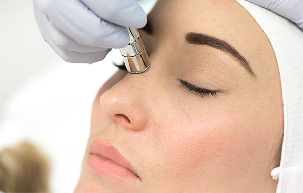 Diamond Microdermabrasion Featured Image
