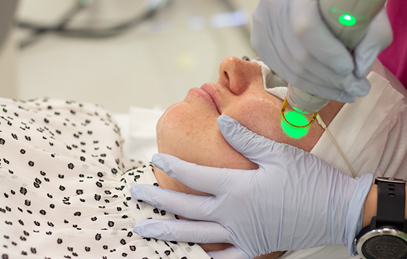 Laser for pigmentation Treatment - Skin Rejuvenation