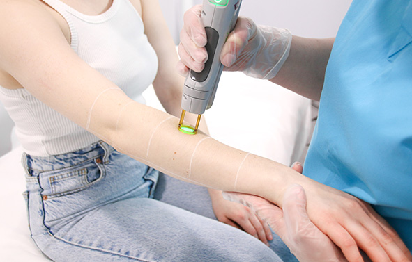 A Laser Technician is Processing Laser Hair Removal Treatment on Patient's Arm