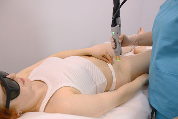 A Laser Technician is Processing Laser Hair Removal Treatment on the Bikini Part of a Patient