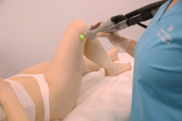 ADD Thigh Patch - Back or Front (Hand Size) Featured Image