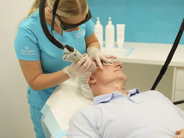 laser for veins - 5 mins