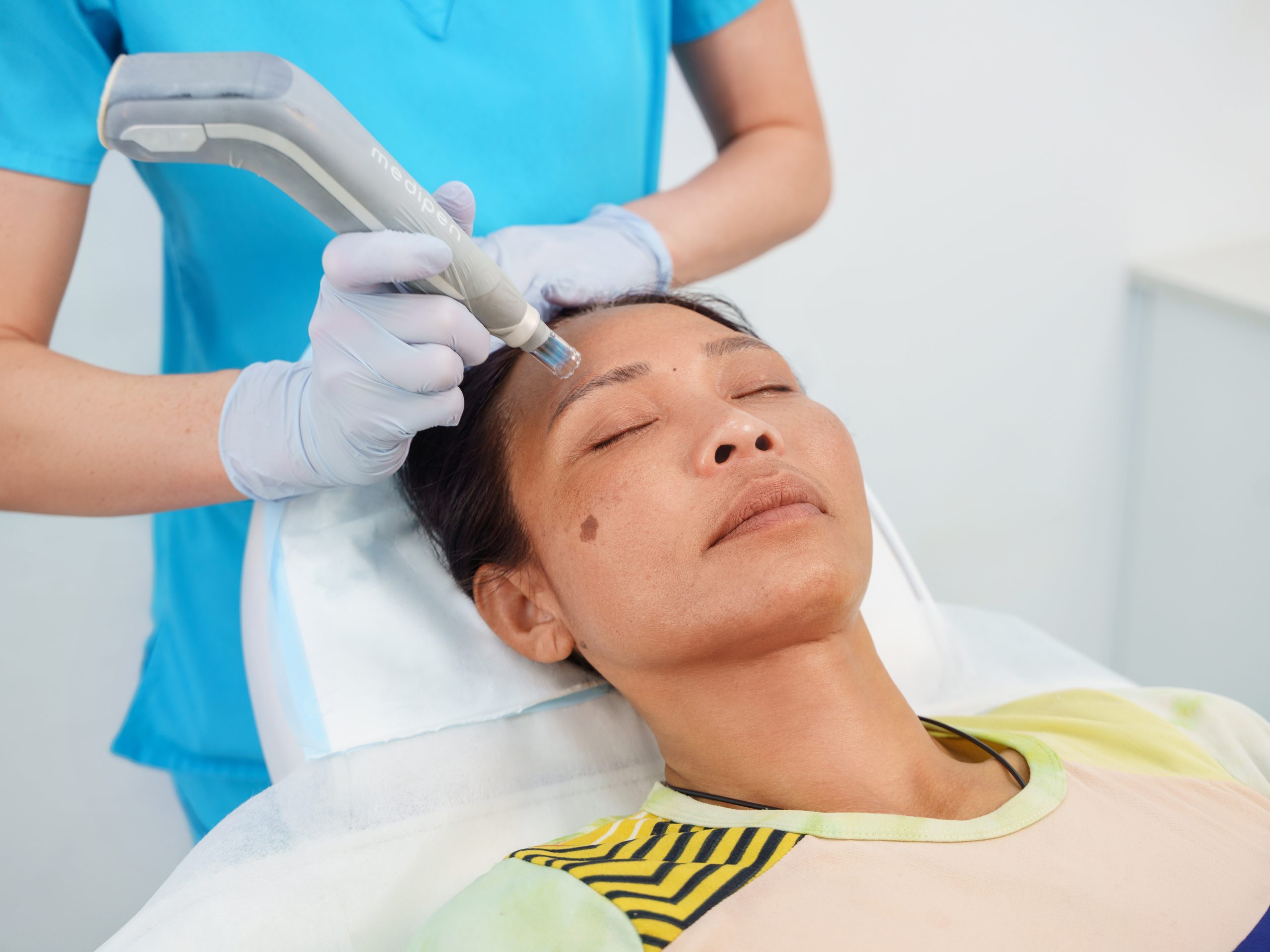 Our powerhouse treatment: Microneedling