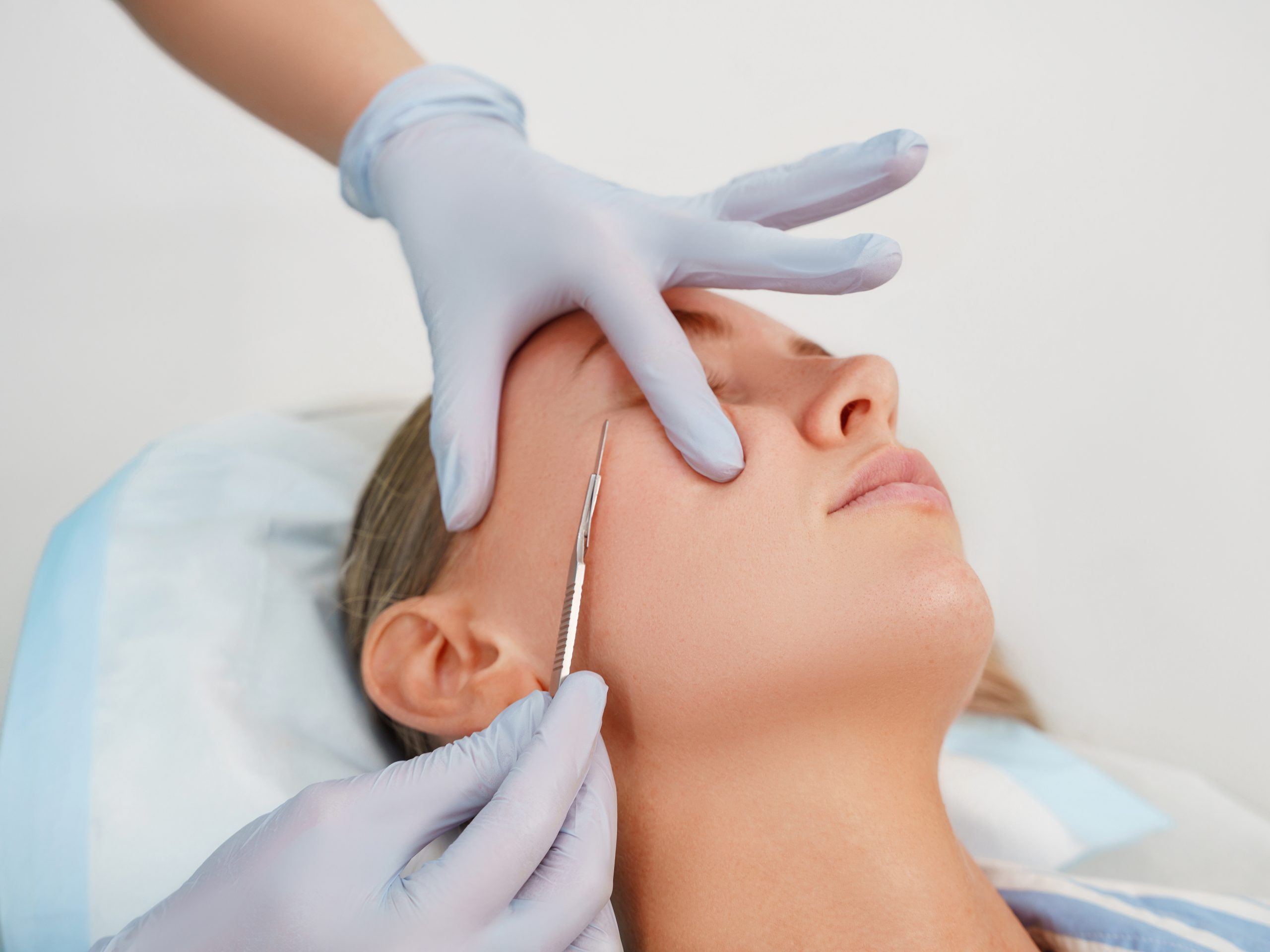 Dermaplaning: benefits and myth busters!