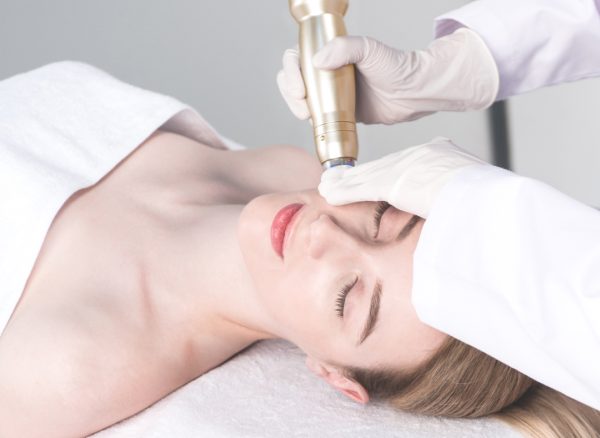 sylfirm x™ rf needling - full face (ex eyes)