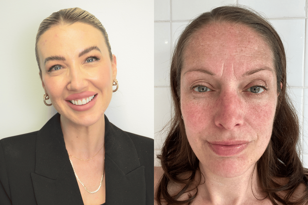 Pigmentation in your 40s hits different. Here’s what an expert wants you to know.