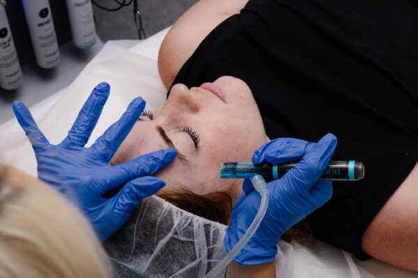 ADD Hydrafacial® Eye Perks Featured Image