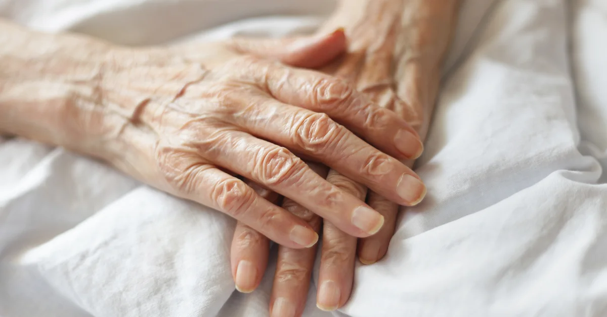 ageing hands